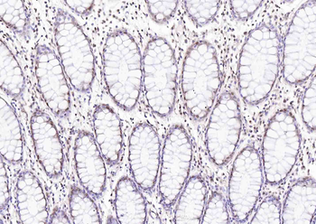 Phospho-LKB1 (Ser428) Rabbit Polyclonal Antibody