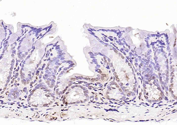 Phospho-LKB1 (Ser428) Rabbit Polyclonal Antibody