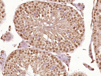 Phospho-LKB1 (Ser428) Rabbit Polyclonal Antibody