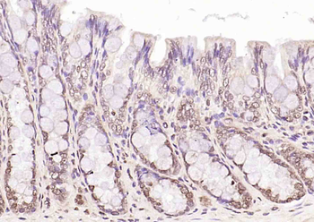 Phospho-LKB1 (Ser428) Rabbit Polyclonal Antibody