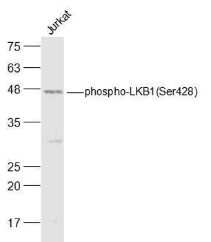 Phospho-LKB1 (Ser428) Rabbit Polyclonal Antibody