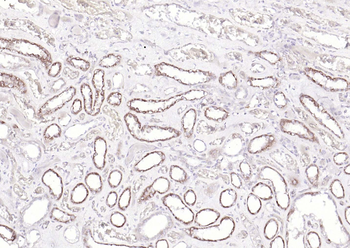 TNFR1 Rabbit Polyclonal Antibody