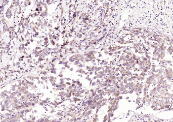 TNFR1 Rabbit Polyclonal Antibody