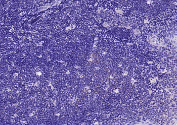 TNFR1 Rabbit Polyclonal Antibody