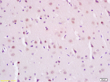 Phospho-SIRT1 (Ser47) Rabbit Polyclonal Antibody