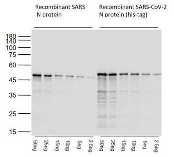 SARS-CoV-2 N Rabbit Polyclonal Antibody