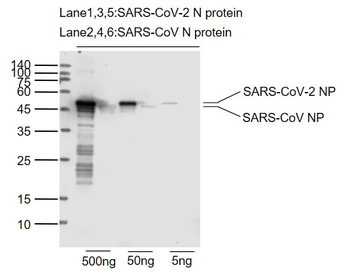 SARS-CoV-2 (2019-nCoV) Nucleocapsid Mouse Monoclonal Antibody
