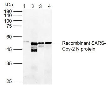 SARS-CoV-2 (2019-nCoV) Nucleocapsid Mouse Monoclonal Antibody