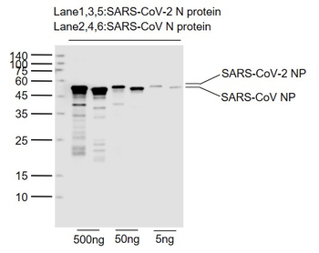 SARS-CoV-2 (2019-nCoV) Nucleocapsid Mouse Monoclonal Antibody