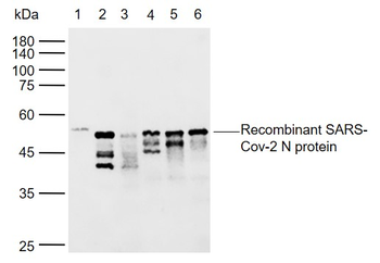 SARS-CoV-2 (2019-nCoV) Nucleocapsid Mouse Monoclonal Antibody