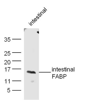 Intestinal FABP Rabbit Polyclonal Antibody