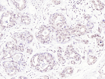 FAK Rabbit Polyclonal Antibody