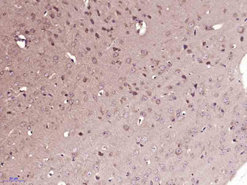 FAK Rabbit Polyclonal Antibody