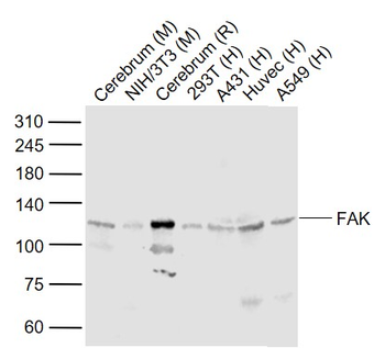 FAK Rabbit Polyclonal Antibody