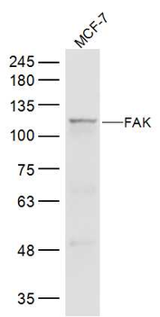FAK Rabbit Polyclonal Antibody