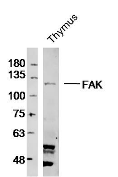 FAK Rabbit Polyclonal Antibody