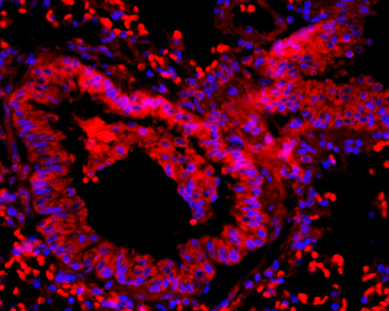 FAK Rabbit Polyclonal Antibody