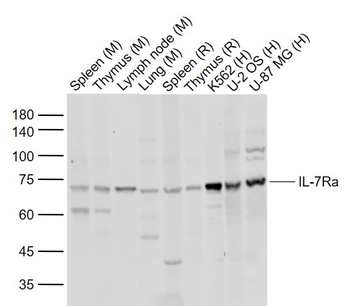IL7R Rabbit Polyclonal Antibody