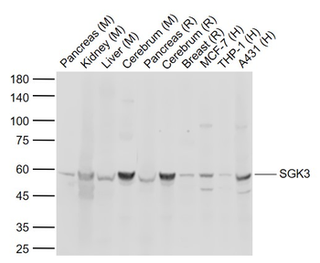 SGK3 Rabbit Polyclonal Antibody