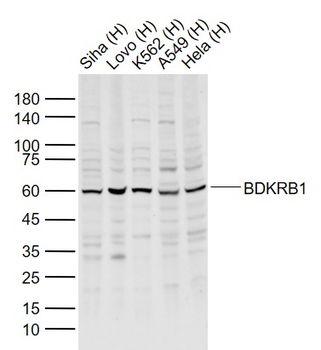 BDKRB1 Rabbit Polyclonal Antibody