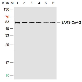SARS-CoV-2 (2019-nCoV) Nucleocapsid, WT & Ormicron Recognized Mouse Monoclonal Antibody