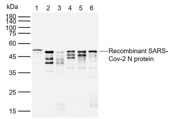 SARS-CoV-2 (2019-nCoV) Nucleocapsid, WT & Ormicron Recognized Mouse Monoclonal Antibody