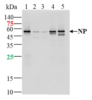 SARS-CoV-2 (2019-nCoV) Nucleocapsid, WT & Ormicron Recognized Mouse Monoclonal Antibody