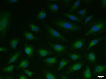 Phospho-FAK (Ser732) Rabbit Polyclonal Antibody