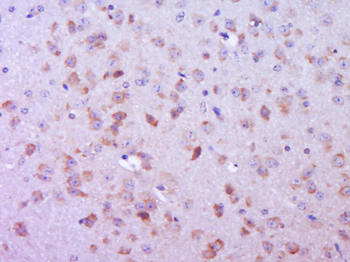 Phospho-FAK (Ser732) Rabbit Polyclonal Antibody