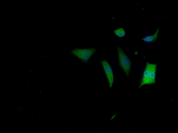 FGF1 Rabbit Polyclonal Antibody