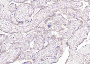 FGF5 Rabbit Polyclonal Antibody