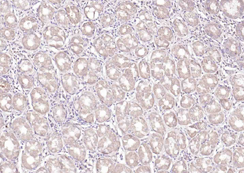 FGF5 Rabbit Polyclonal Antibody