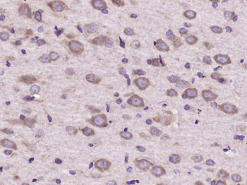 FGF5 Rabbit Polyclonal Antibody