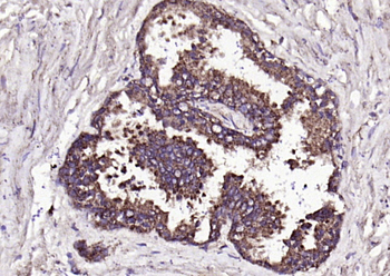 FGF8 Rabbit Polyclonal Antibody