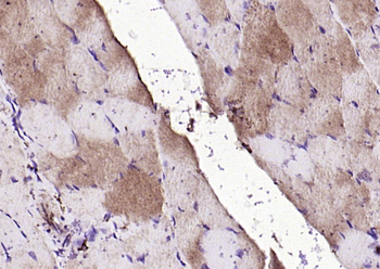 FGF8 Rabbit Polyclonal Antibody