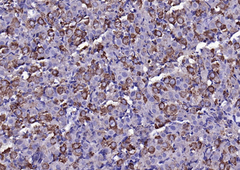 FGF8 Rabbit Polyclonal Antibody