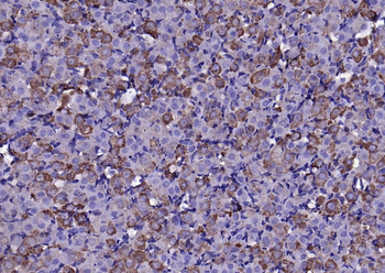 FGF8 Rabbit Polyclonal Antibody