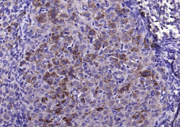 FGF8 Rabbit Polyclonal Antibody