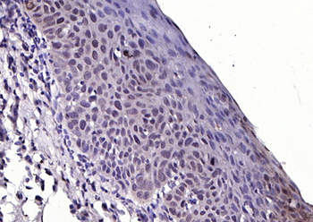 FGFR1 Rabbit Polyclonal Antibody