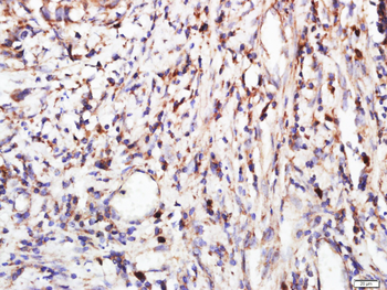 FGFR2 Rabbit Polyclonal Antibody