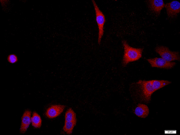 FGFR2 Rabbit Polyclonal Antibody