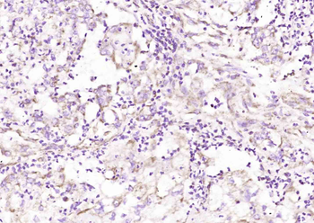 PI-15 Rabbit Polyclonal Antibody