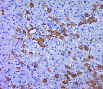 FLIP Rabbit Polyclonal Antibody