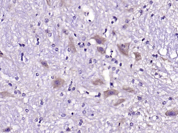 Fibronectin/FN1 Rabbit Polyclonal Antibody