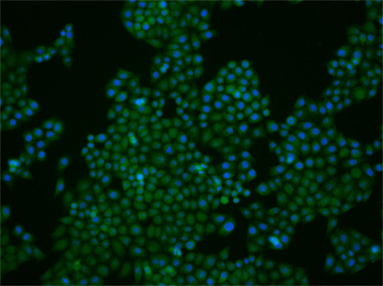 FoxP1 Rabbit Polyclonal Antibody