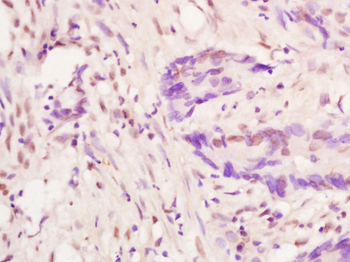 FoxP3 Rabbit Polyclonal Antibody