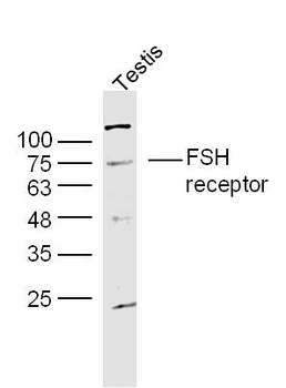 FSH receptor Rabbit Polyclonal Antibody