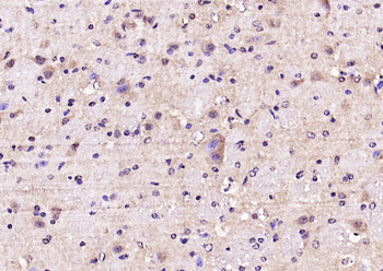 GNB1 Rabbit Polyclonal Antibody