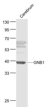 GNB1 Rabbit Polyclonal Antibody