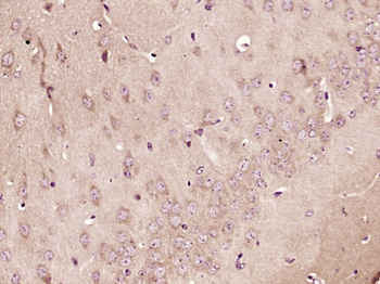 GABBR2 Rabbit Polyclonal Antibody